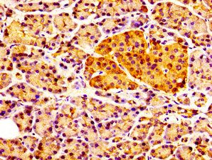 CCKAR Antibody