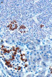 Goat anti-CCKAR Antibody