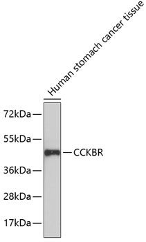 CCKBR antibody