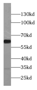 CCKBR-specific antibody