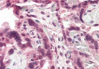 Goat anti-CCKBR Antibody