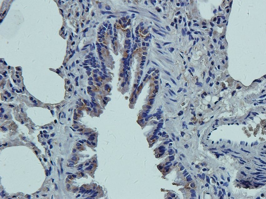 CCKN Rabbit Polyclonal Antibody