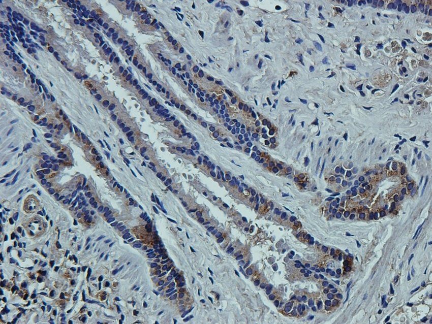 CCKN Rabbit Polyclonal Antibody