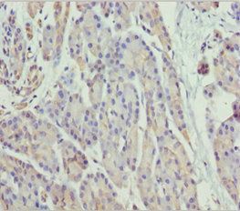 SCYL1 Antibody