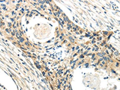 CCL13 Antibody