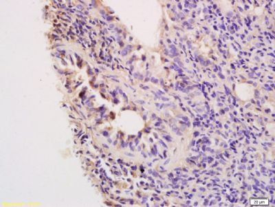 MCP4 Rabbit Polyclonal Antibody