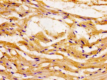 CCL15 Antibody