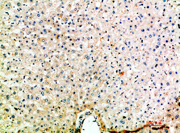CCL15 Antibody