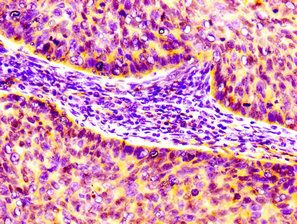 CCL17 antibody