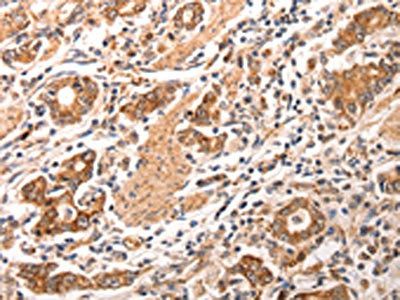 CCL17 Antibody