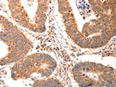 CCL17 Antibody