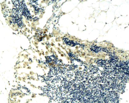 CCL17 Rabbit Polyclonal Antibody