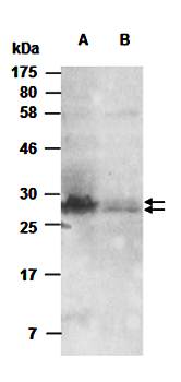 CCL1 antibody