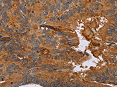 CCL21 Antibody