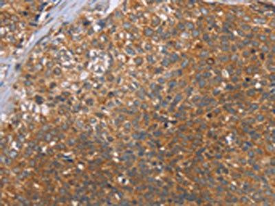 CCL21 Antibody