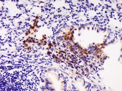 CCL22 Rabbit Polyclonal Antibody
