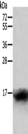 CCL24 antibody