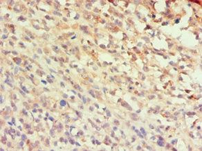 CCL25 antibody