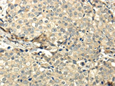 CCL25 Antibody