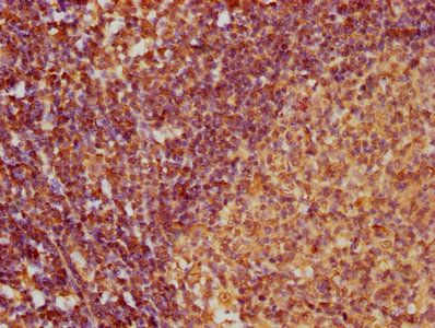 CCL27 Antibody
