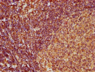 CCL27 antibody