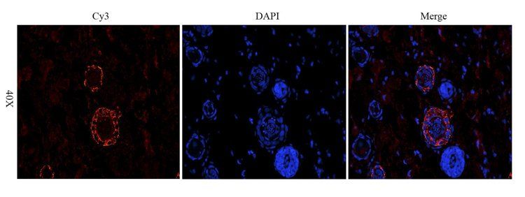 MCP1 Rabbit Polyclonal Antibody