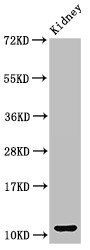 CCL3 antibody