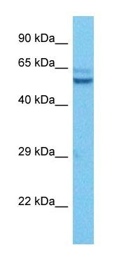 CCM2 antibody