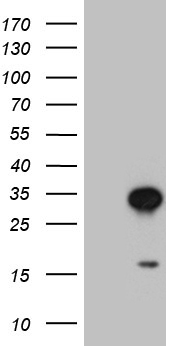 CCN2 antibody