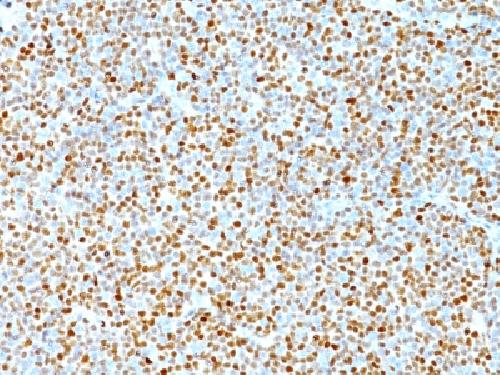 Cyclin D1 (G1-Cyclin & Mantle Cell Marker) Antibody