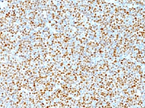 CCND1 antibody