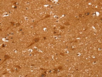 CCND2 Antibody