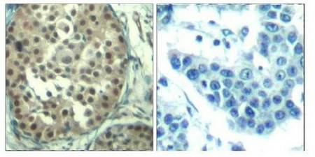 CCNE1 (Ab-395) Antibody