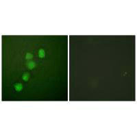 CCNE1 (Ab-395) Antibody