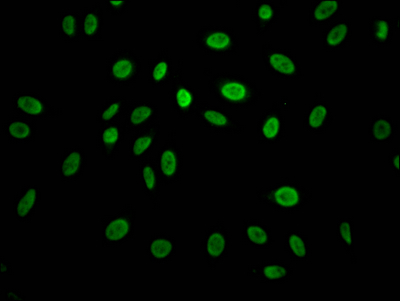 CCNE1 Recombinant Monoclonal Antibody