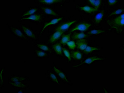 CCNE1 Recombinant Monoclonal Antibody