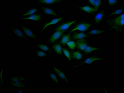 CCNE1 antibody