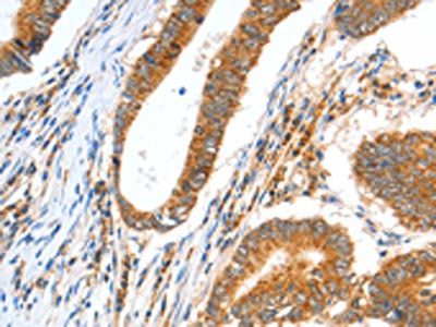 CCNF Antibody