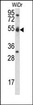 CCNI antibody
