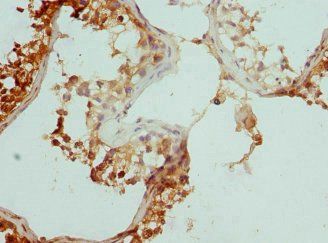 CCP110 Antibody