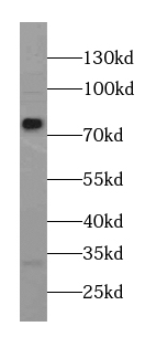 CCP5 antibody