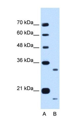 CCPG1 antibody