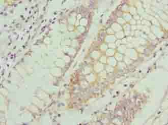 CCR1 Antibody