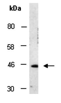CCR1 (C) Antibody, Rabbit Polyclonal