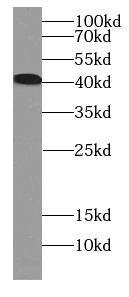 CCR2-specific antibody