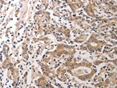 CCR3 Antibody