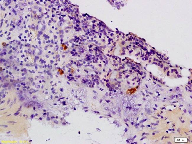 CCR3 Rabbit Polyclonal Antibody