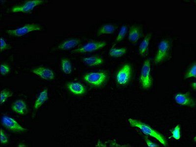 CCR4 antibody