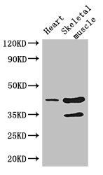 CCR5 antibody