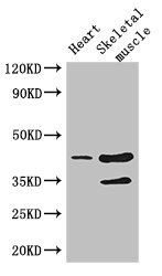 CCR5 Antibody